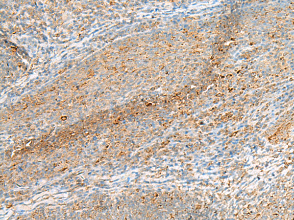 Rabbit Polyclonal Antibody to IZUMO1R