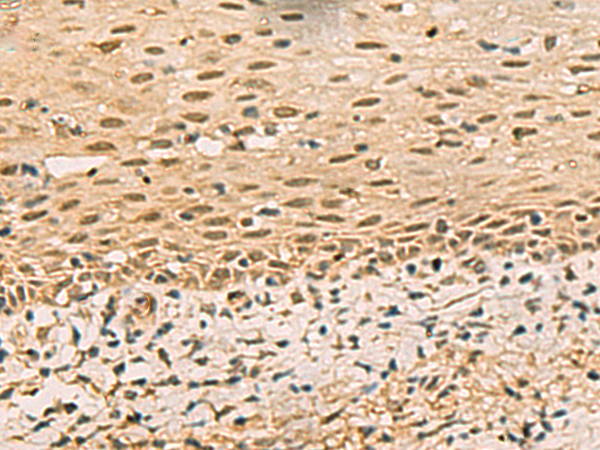 Rabbit Polyclonal Antibody to FOXH1