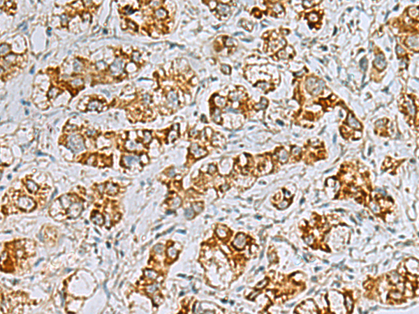 Rabbit Polyclonal Antibody to FAAP100