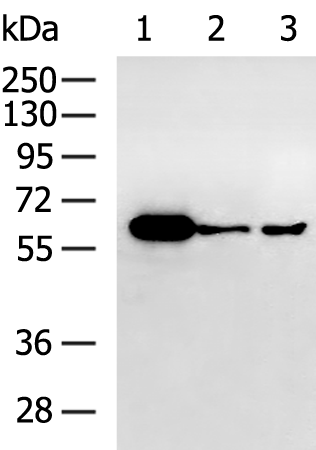 Rabbit Polyclonal Antibody to SQSTM1