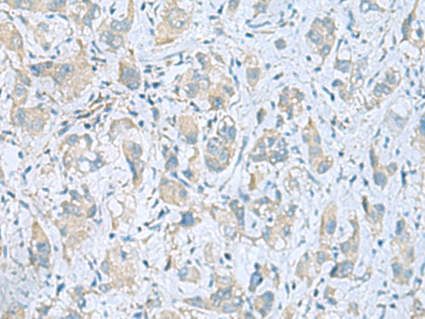 Rabbit Polyclonal Antibody to PLN