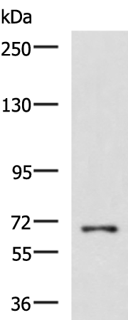 Rabbit Polyclonal Antibody to FUBP1