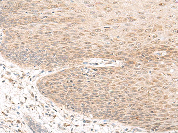 Rabbit Polyclonal Antibody to FUT10