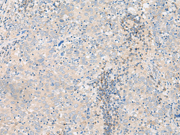 Rabbit Polyclonal Antibody to FUT3