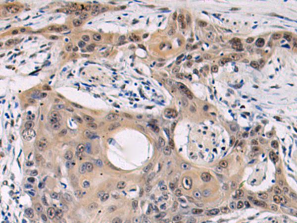 Rabbit Polyclonal Antibody to GPER1