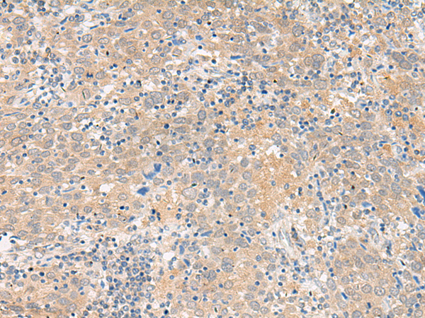 Rabbit Polyclonal Antibody to GALP
