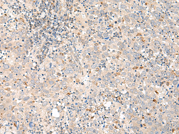 Rabbit Polyclonal Antibody to GALR1
