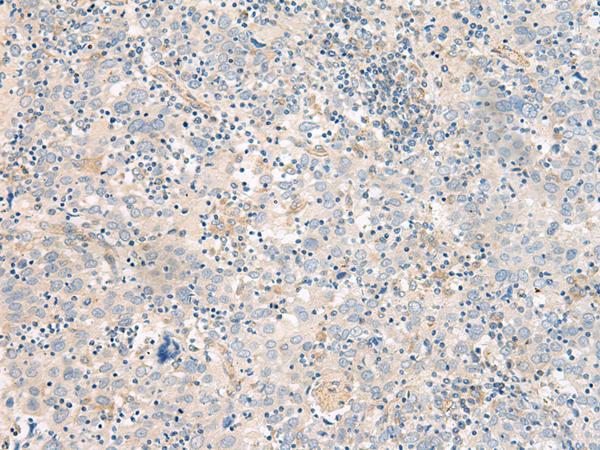 Rabbit Polyclonal Antibody to GART