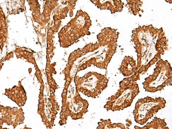 Rabbit Polyclonal Antibody to GBP4