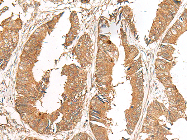 Rabbit Polyclonal Antibody to GCC2