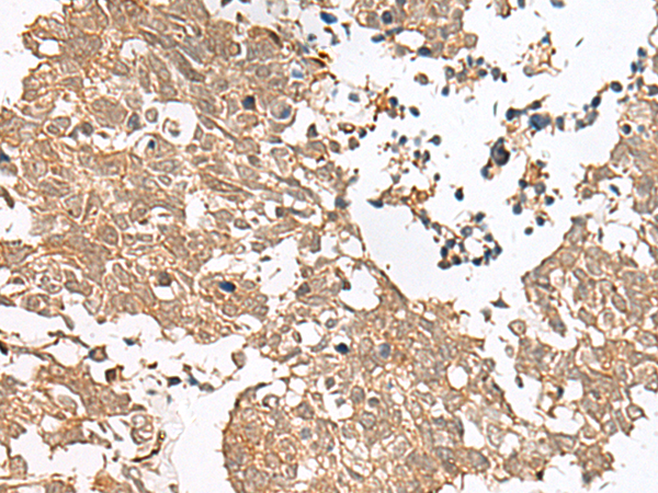 Rabbit Polyclonal Antibody to GRASP