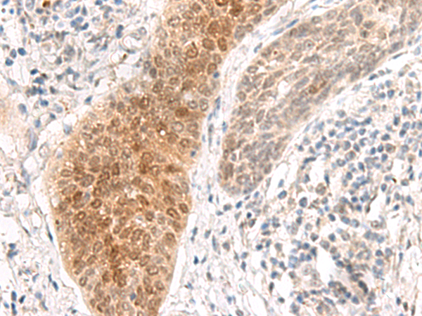 Rabbit Polyclonal Antibody to GHDC