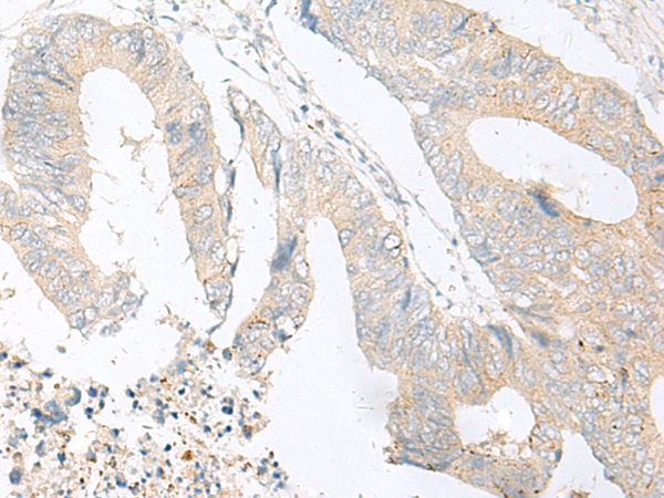 Rabbit Polyclonal Antibody to MBOAT4