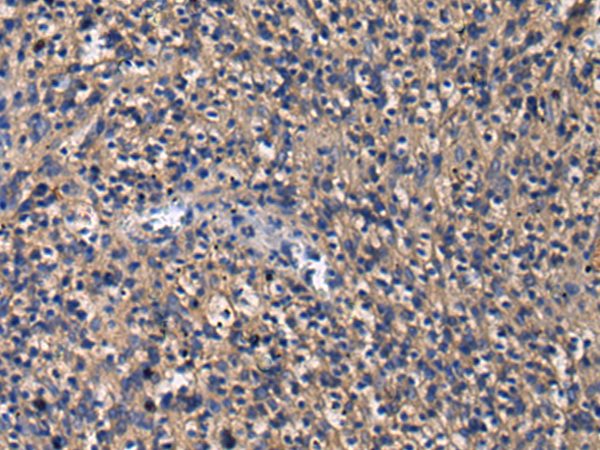 Rabbit Polyclonal Antibody to GIGYF1