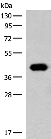 Rabbit Polyclonal Antibody to GIPC1