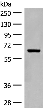 Rabbit Polyclonal Antibody to GLS2
