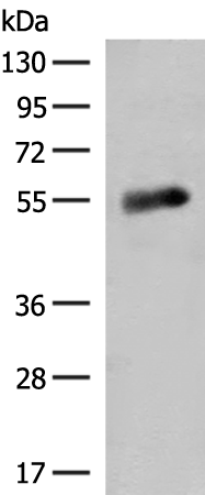 Rabbit Polyclonal Antibody to GLUD1