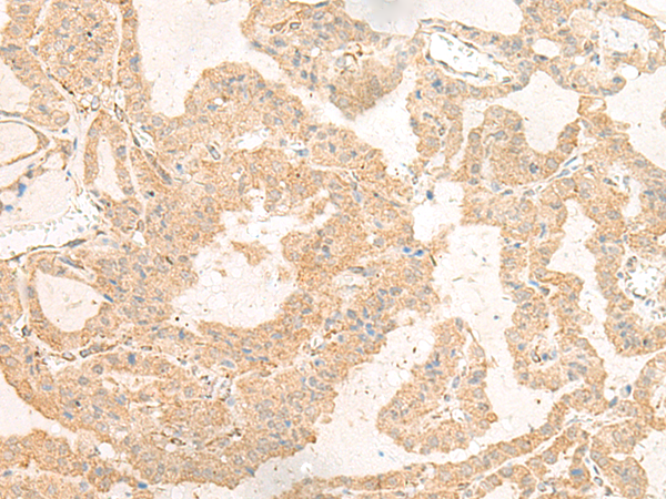 Rabbit Polyclonal Antibody to GNAT3