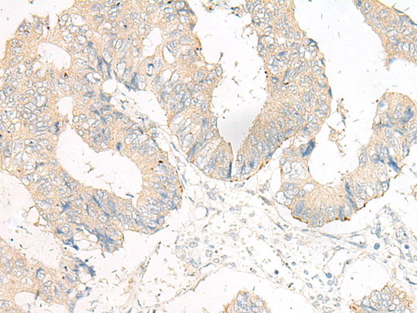 Rabbit Polyclonal Antibody to GOLGA5