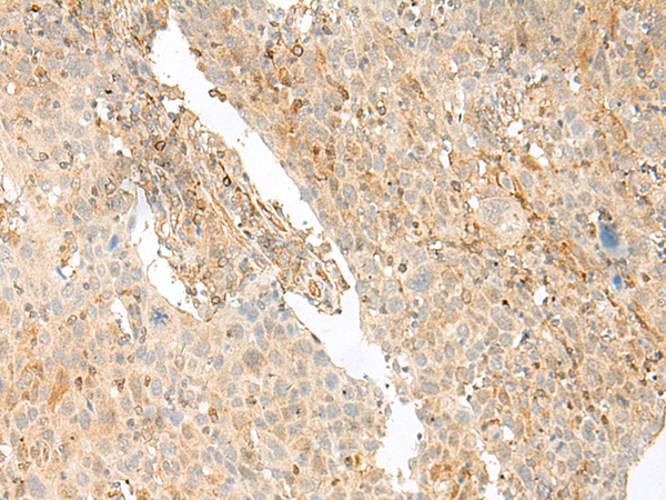 Rabbit Polyclonal Antibody to GOLIM4