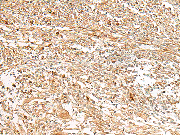 Rabbit Polyclonal Antibody to GPR151