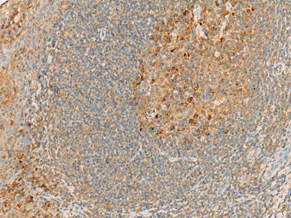 Rabbit Polyclonal Antibody to GPR132