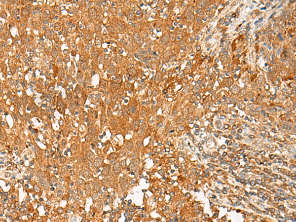 Rabbit Polyclonal Antibody to GPR1