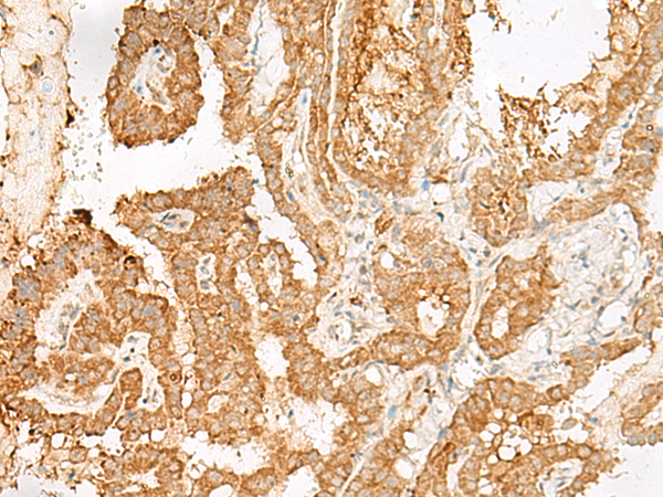 Rabbit Polyclonal Antibody to ADGRF1