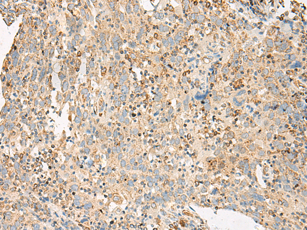 Rabbit Polyclonal Antibody to ADGRG6