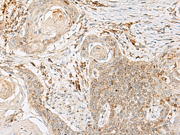 Rabbit Polyclonal Antibody to GPR17