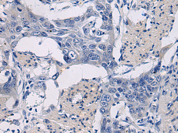 Rabbit Polyclonal Antibody to GPR18