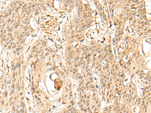 Rabbit Polyclonal Antibody to SNAPC5