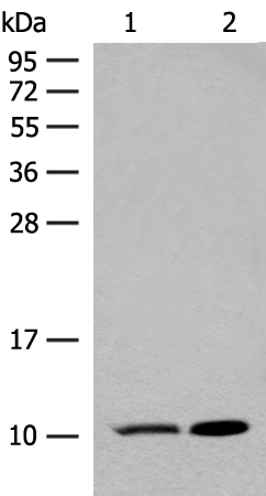 Rabbit Polyclonal Antibody to RPS28