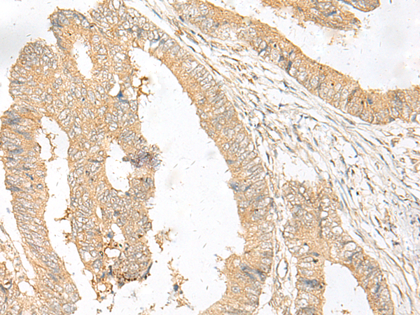 Rabbit Polyclonal Antibody to MSRB1