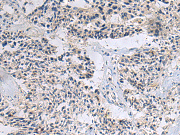 Rabbit Polyclonal Antibody to CCL22