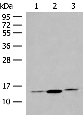 Rabbit Polyclonal Antibody to HBB