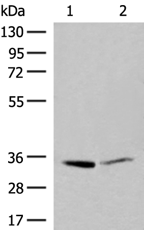 Rabbit Polyclonal Antibody to LDHA