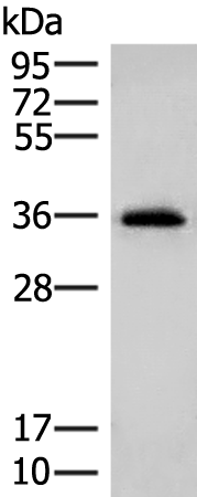 Rabbit Polyclonal Antibody to MS4A1