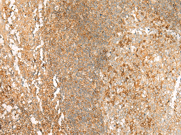 Rabbit Polyclonal Antibody to HLA-G