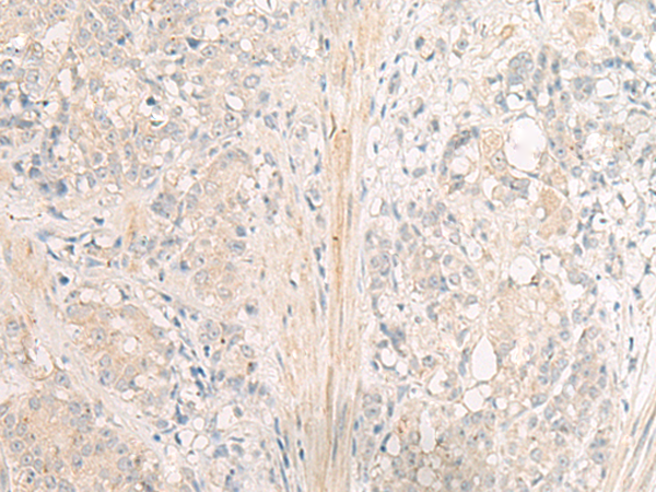 Rabbit Polyclonal Antibody to GPR26
