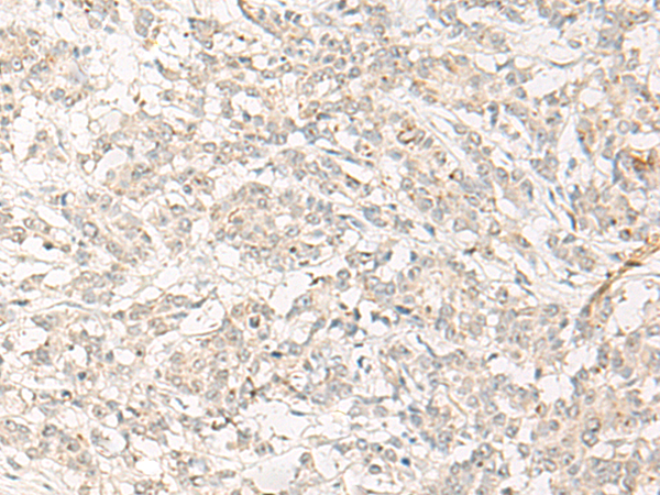 Rabbit Polyclonal Antibody to GPR32