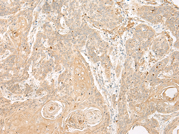 Rabbit Polyclonal Antibody to TAAR2