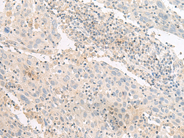Rabbit Polyclonal Antibody to GPR63