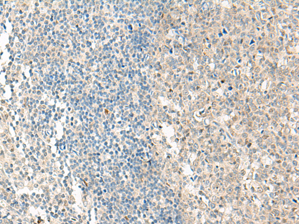 Rabbit Polyclonal Antibody to NPBWR1
