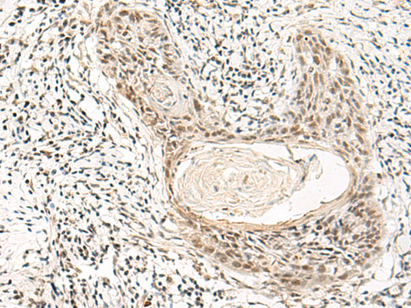 Rabbit Polyclonal Antibody to ADGRG1