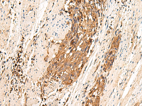 Rabbit Polyclonal Antibody to MRGPRD