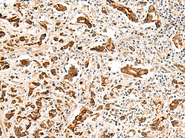 Rabbit Polyclonal Antibody to GPR160