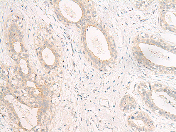 Rabbit Polyclonal Antibody to GPR157