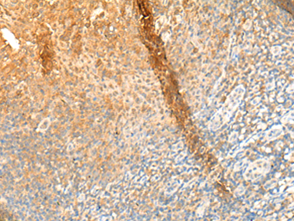 Rabbit Polyclonal Antibody to GPR162