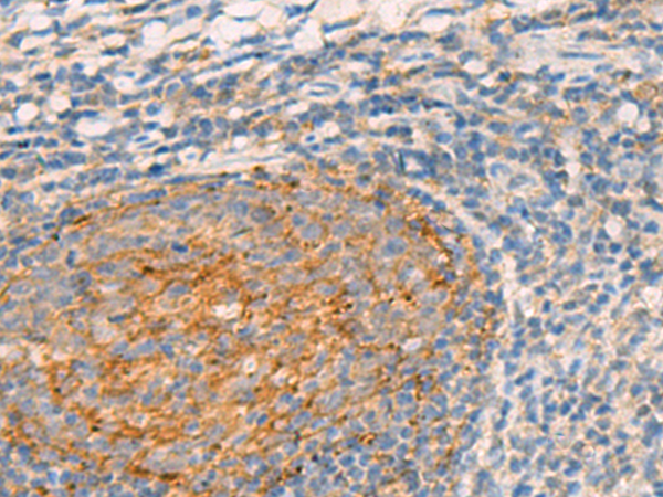 Rabbit Polyclonal Antibody to WLS